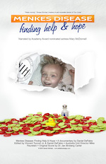 A movie poster reading Menkes Disease: Finding Help and Hope. Red and green plastic discs sit in a pile at the bottom of the poster and in the middle, paper is torn back to reveal a smiling baby.